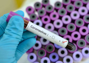 Coronavirus: reporte diario sobre los casos en la Provincia