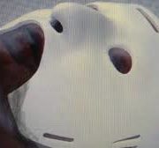 Crean una máscara 3D para curar quemaduras faciales